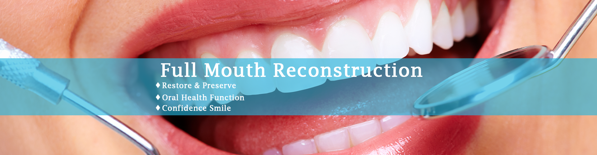 Full Mouth Rehabilitation
