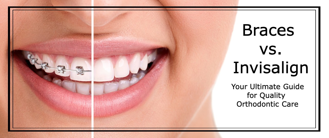 Braces Treatment/ Invisible Braces / Invisalign