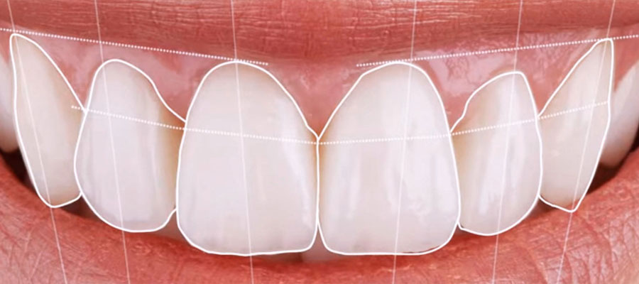 Digital Smile Design 