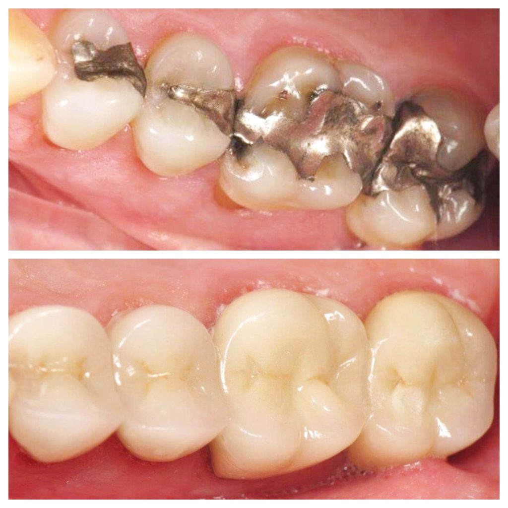 Dental Exams & Cleanings
